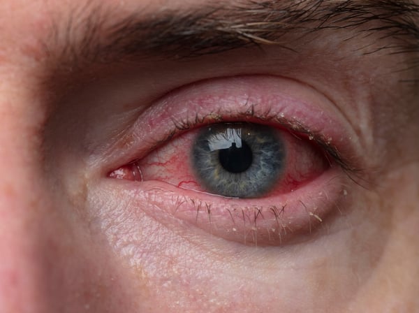 5 Scary Symptoms That Are Usually Harmless