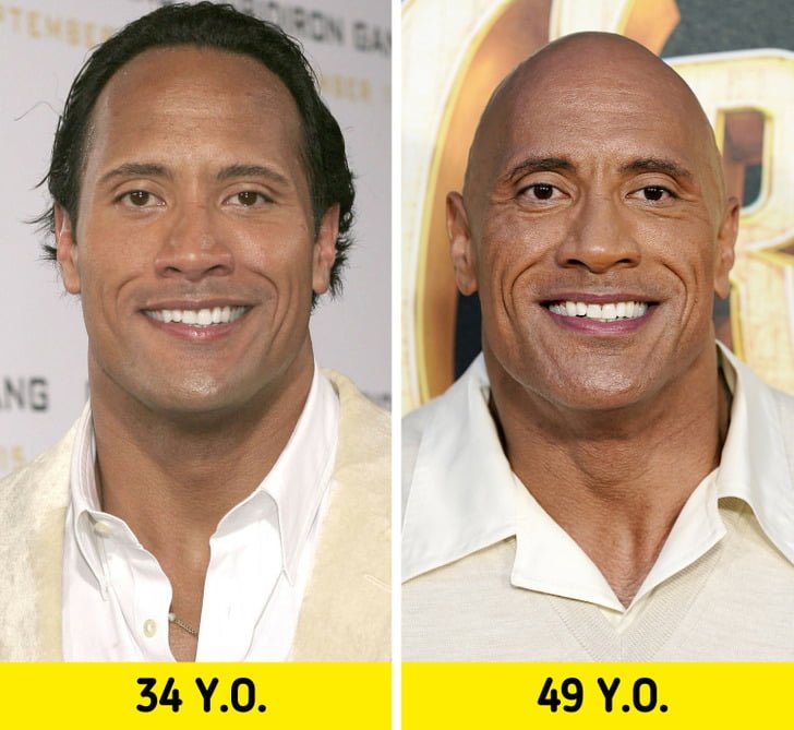 18 Celebrities Who Shocked the World With Their Transformation