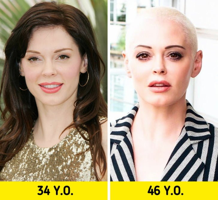 18 Celebrities Who Shocked the World With Their Transformation