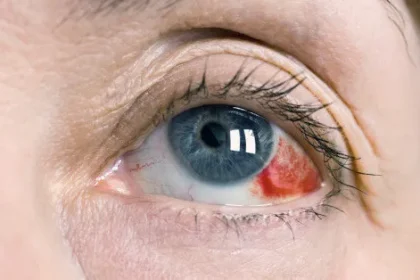 5 Scary Symptoms That Are Usually Harmless