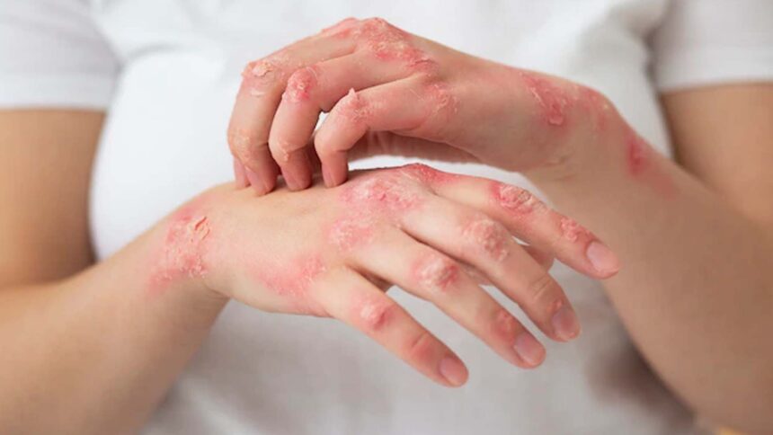 Skin Conditions: Top 10 Most Common