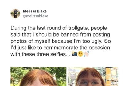 Woman Who Was Called ‘Too Ugly’ After Posting Her Photos Proves Bullies Wrong & Models at NY Fashion Week