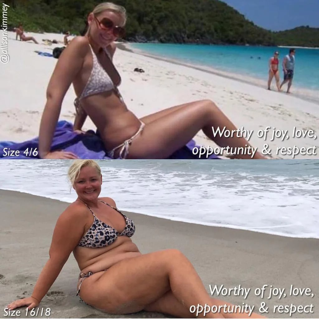 Before-And-After/ Models Promote Self-Love By Sharing Their Bodies’ Journey