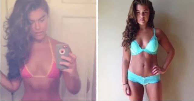 Before-And-After/ Models Promote Self-Love By Sharing Their Bodies’ Journey