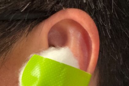 Put a cotton ball with VapoRub in your ear & get this remarkable effect