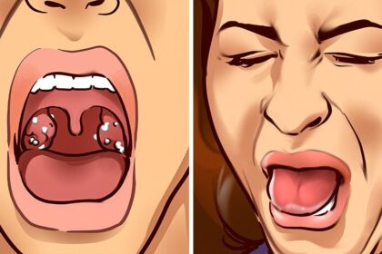 9 Things a Bad Taste in Your Mouth Is Trying to Tell You